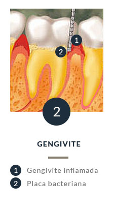 Periodontia