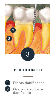 Periodontia