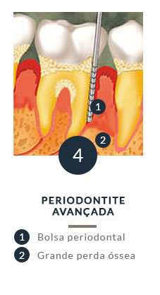 Periodontia