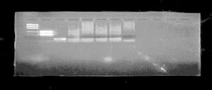 Aspectos Clínicos E Histológicos En La Queilitis Actínica Crónica, Su Relación Con El Virus Del Papiloma Humano - 1