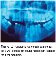 The Importance Of Thorough Clinical And Histopathologic Evaluation In The Proper Diagnosis And Treatment Of Benign And Malignant Lesions