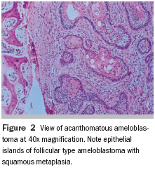 The Importance Of Thorough Clinical And Histopathologic Evaluation In The Proper Diagnosis And Treatment Of Benign And Malignant Lesions