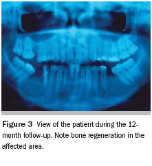 The Importance Of Thorough Clinical And Histopathologic Evaluation In The Proper Diagnosis And Treatment Of Benign And Malignant Lesions