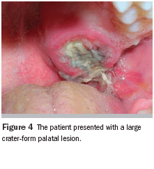 The Importance Of Thorough Clinical And Histopathologic Evaluation In The Proper Diagnosis And Treatment Of Benign And Malignant Lesions