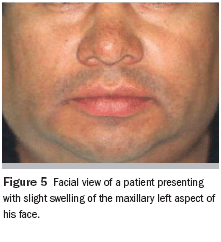 The Importance Of Thorough Clinical And Histopathologic Evaluation In The Proper Diagnosis And Treatment Of Benign And Malignant Lesions