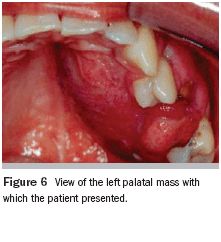 The Importance Of Thorough Clinical And Histopathologic Evaluation In The Proper Diagnosis And Treatment Of Benign And Malignant Lesions