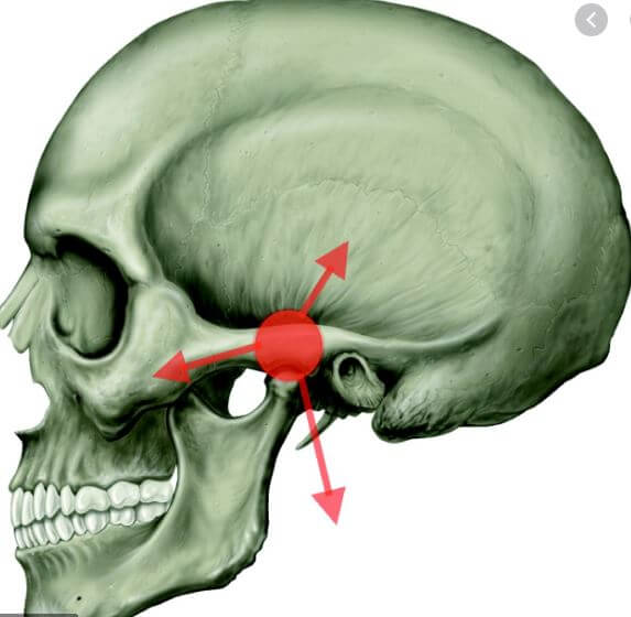 Disfunção da articulação temporomandibular (ATM).